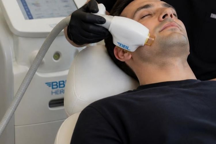 Acne and Acne-Scar Treatment