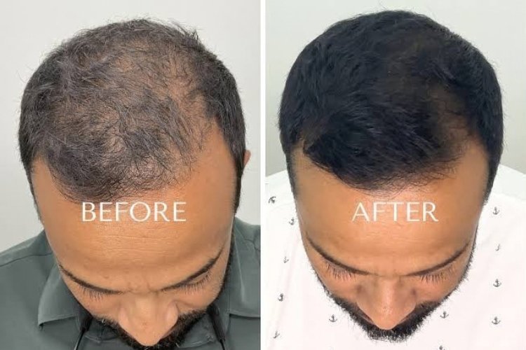 Hair and aesthetic care at Shri Aesthetics