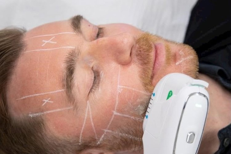 Skin Tightening Treatment Options